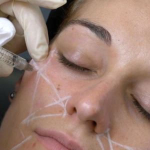 Level 7 Diploma in Injectables