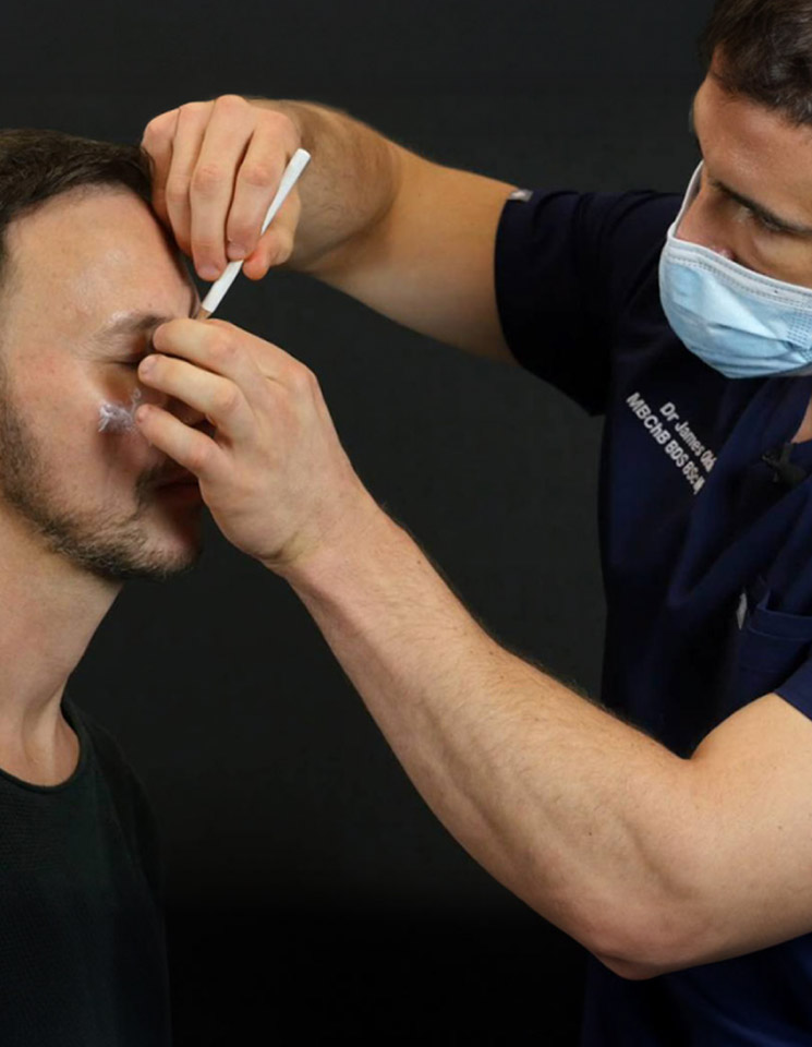 Interface Aesthetics Training Academy - Benefits of being a Model Patient at Interface Aesthetics?